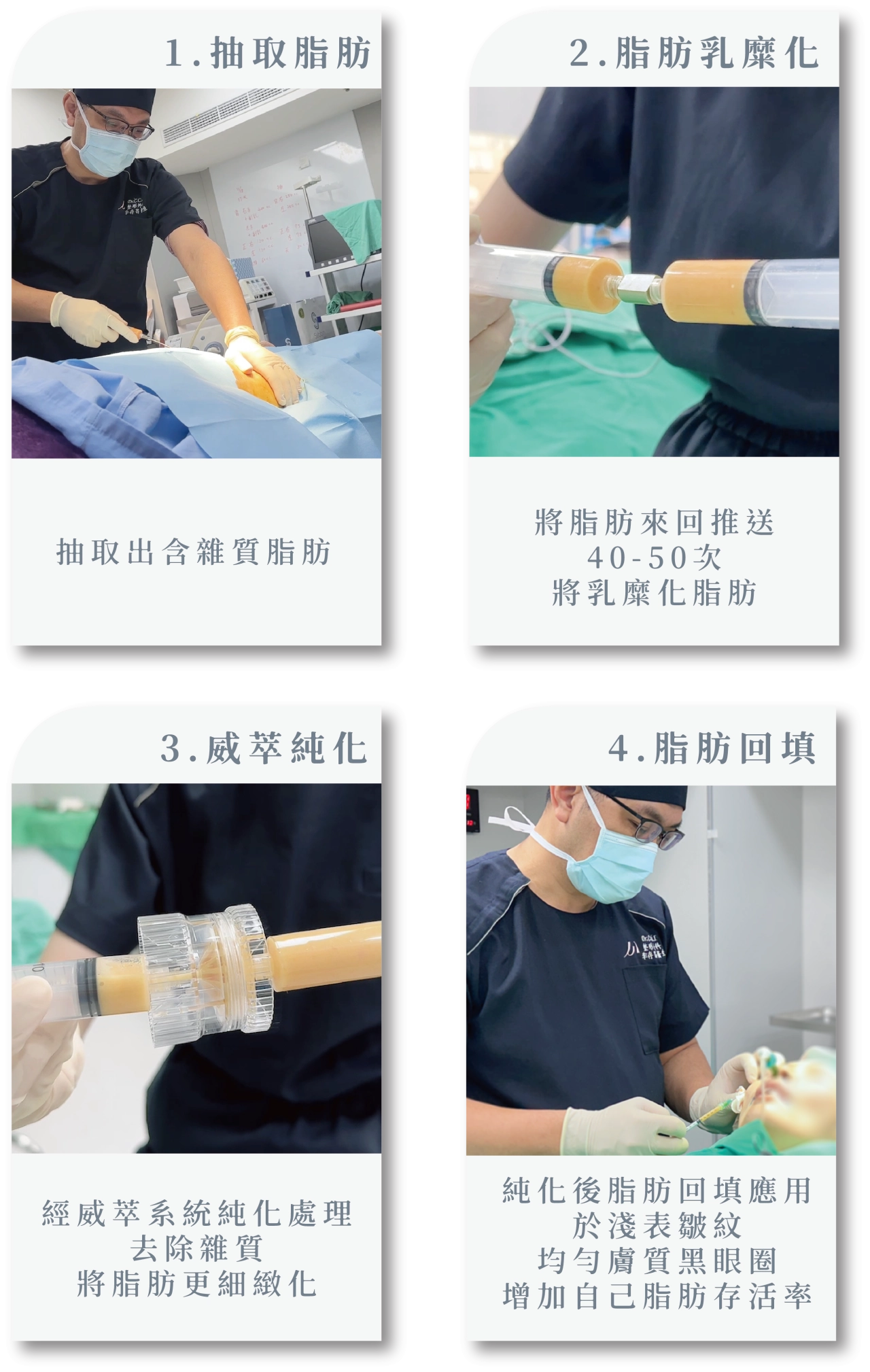 威萃脂肪溶液的使用步驟是：先抽脂，接著將脂肪與威萃混合，最後透過離心，分離出高品質的純脂肪進行回填。