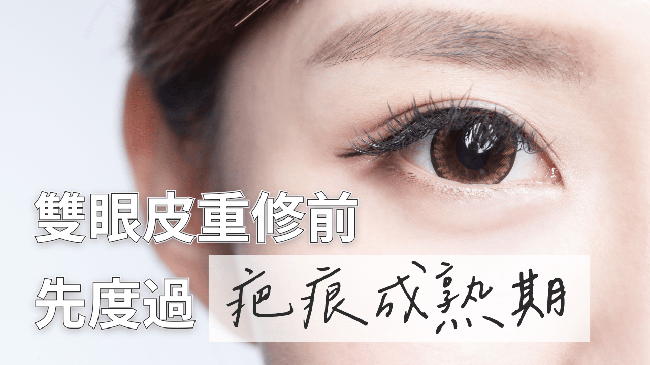 想做雙眼皮重修？先搞懂「疤痕成熟期」才是成功關鍵！