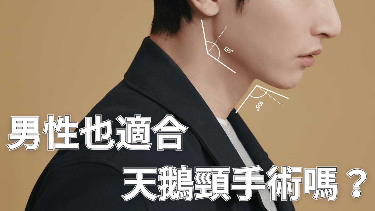 男性也適合天鵝頸手術嗎?醫師解析性別差異