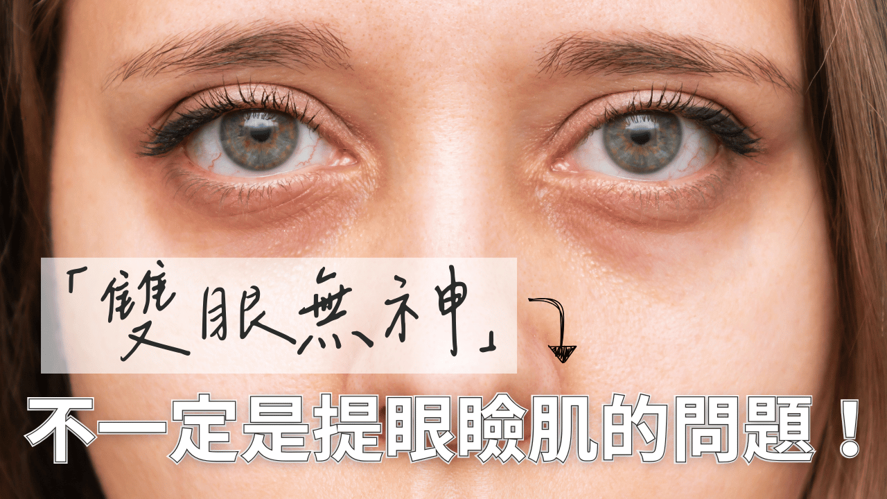 看起來總是沒睡飽?「眼睛無神」不一定是提眼瞼肌的問題!