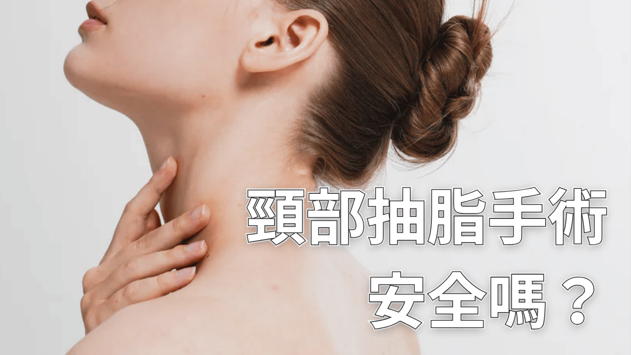 頸部抽脂手術安全嗎？恢復期多久？