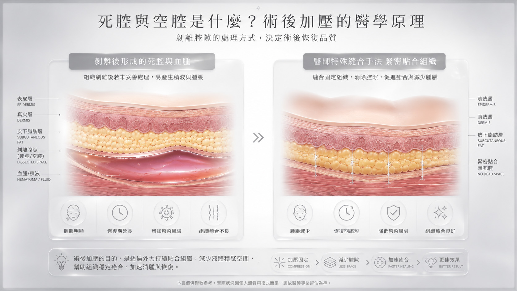 為什麼一般的天鵝頸手術需要戴頭套？術後加壓的醫學原理
